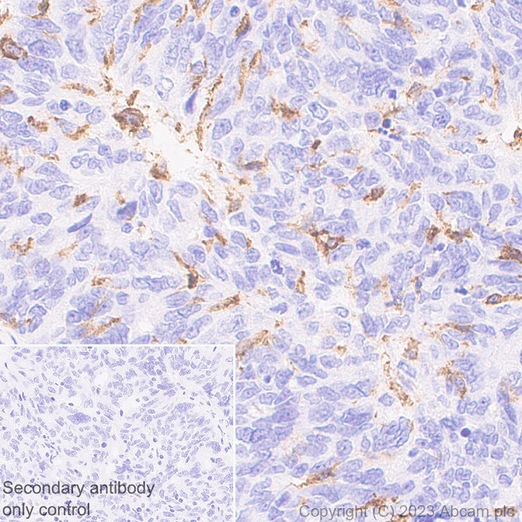 Immunohistochemistry (Formalin/PFA-fixed paraffin-embedded sections) - Anti-CD16 antibody [SP175] - Mouse IgG2a (Chimeric) - BSA and Azide free (AB308606)
