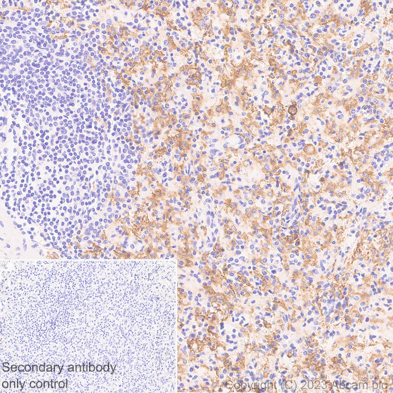 Immunohistochemistry (Formalin/PFA-fixed paraffin-embedded sections) - Anti-CD16 antibody [SP175] - Rat IgG2a (Chimeric) (AB308607)