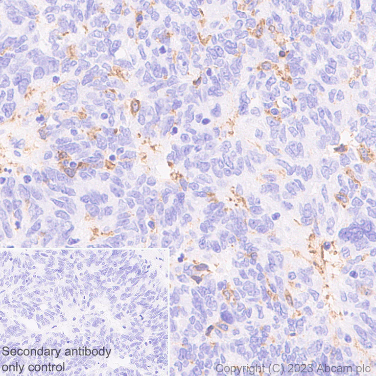 Immunohistochemistry (Formalin/PFA-fixed paraffin-embedded sections) - Anti-CD16 antibody [SP175] - Rat IgG2a (Chimeric) (AB308607)