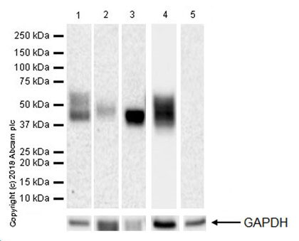 Western blot - Anti-CD16 + CD32 antibody [EPR22345] (AB228971), expandable thumbnail