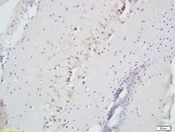 Immunohistochemistry (Formalin/PFA-fixed paraffin-embedded sections) - Anti-CD160 antibody (AB202845)