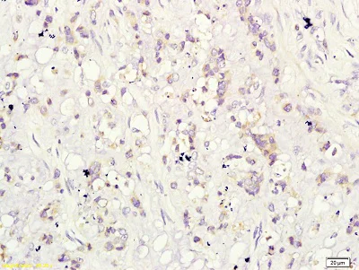 Immunohistochemistry (Formalin/PFA-fixed paraffin-embedded sections) - Anti-CD160 antibody (AB202845)