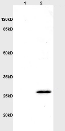 Western blot - Anti-CD160 antibody (AB202845)