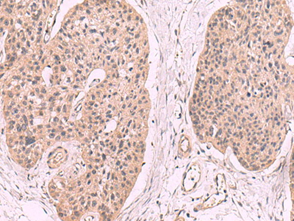 Immunohistochemistry (Formalin/PFA-fixed paraffin-embedded sections) - Anti-CD161 antibody (AB197979)