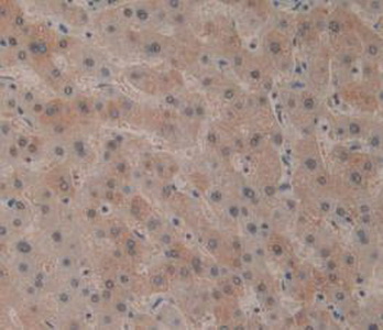 Immunohistochemistry (Formalin/PFA-fixed paraffin-embedded sections) - Anti-CD161 antibody (AB231937)