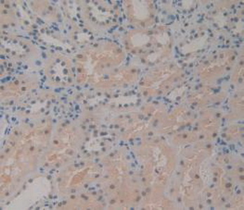 Immunohistochemistry (Formalin/PFA-fixed paraffin-embedded sections) - Anti-CD161 antibody (AB231937)