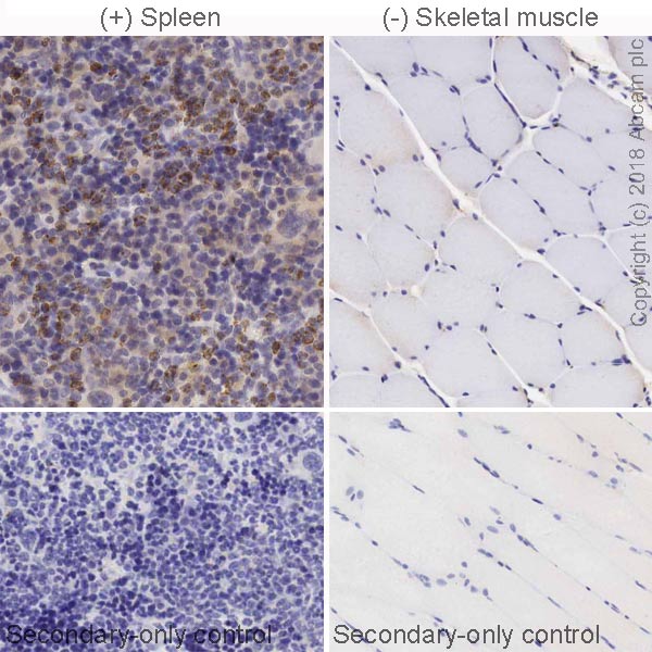 Immunohistochemistry (Formalin/PFA-fixed paraffin-embedded sections) - Anti-CD161 antibody [EPR21236] (AB234107), expandable thumbnail