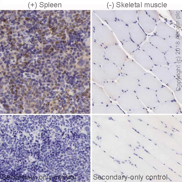 Immunohistochemistry (Formalin/PFA-fixed paraffin-embedded sections) - Anti-CD161 antibody [EPR21236] (AB234107)