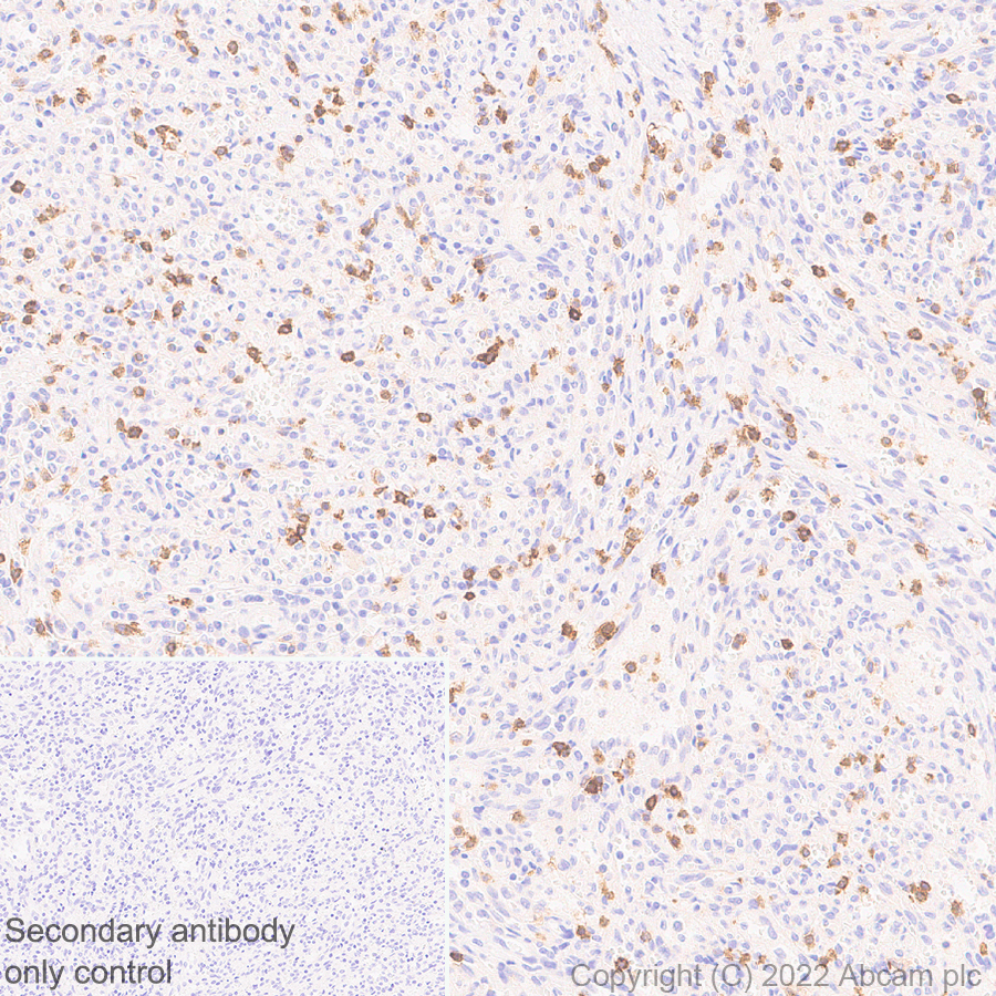 Immunohistochemistry (Formalin/PFA-fixed paraffin-embedded sections) - Anti-CD161 antibody [EPR26340-6] (ab302564), expandable thumbnail