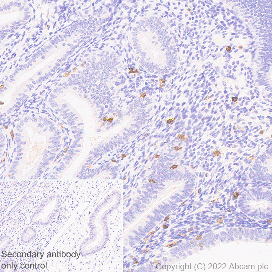 Immunohistochemistry (Formalin/PFA-fixed paraffin-embedded sections) - Anti-CD161 antibody [EPR26340-6] (ab302564), expandable thumbnail