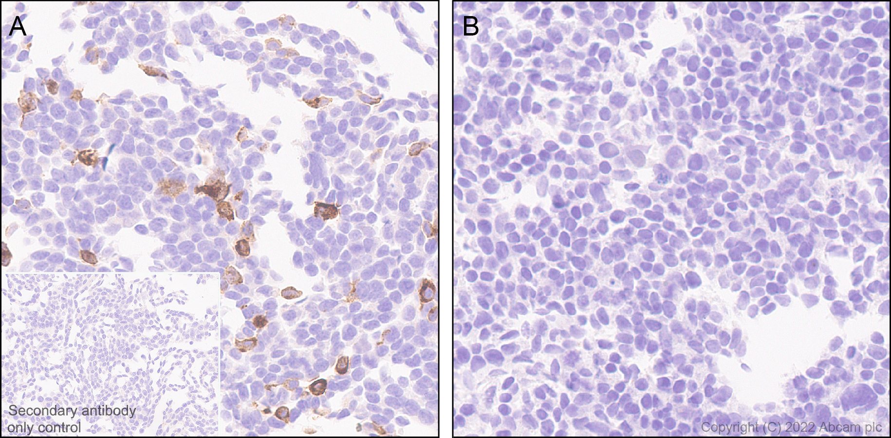 Immunohistochemistry (Formalin/PFA-fixed paraffin-embedded sections) - Anti-CD161 antibody [EPR26340-6] (ab302564), expandable thumbnail