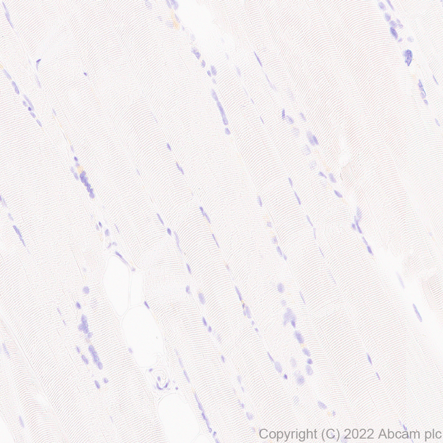 Immunohistochemistry (Formalin/PFA-fixed paraffin-embedded sections) - Anti-CD161 antibody [EPR26340-6] (AB302564), expandable thumbnail
