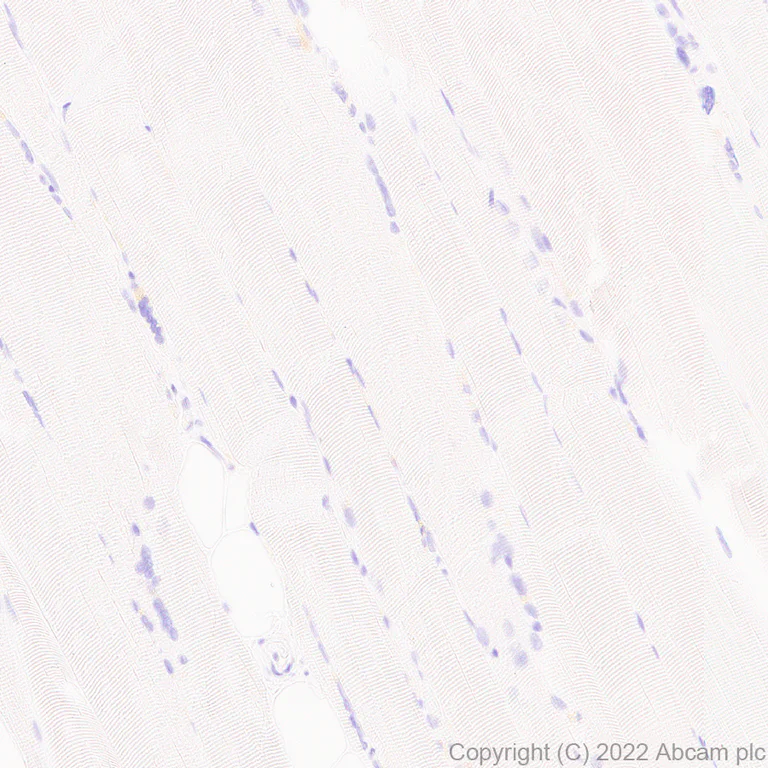 Immunohistochemistry (Formalin/PFA-fixed paraffin-embedded sections) - Anti-CD161 antibody [EPR26340-6] (AB302564)
