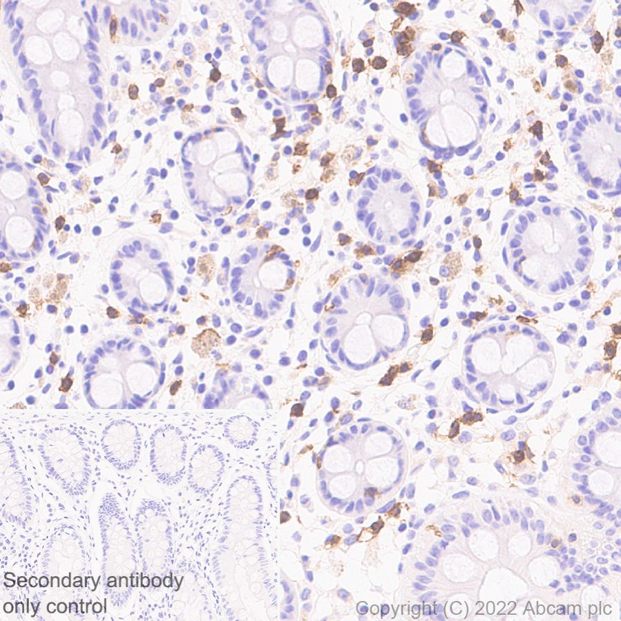 Immunohistochemistry (Formalin/PFA-fixed paraffin-embedded sections) - Anti-CD161 antibody [EPR26340-6] (AB302564), expandable thumbnail