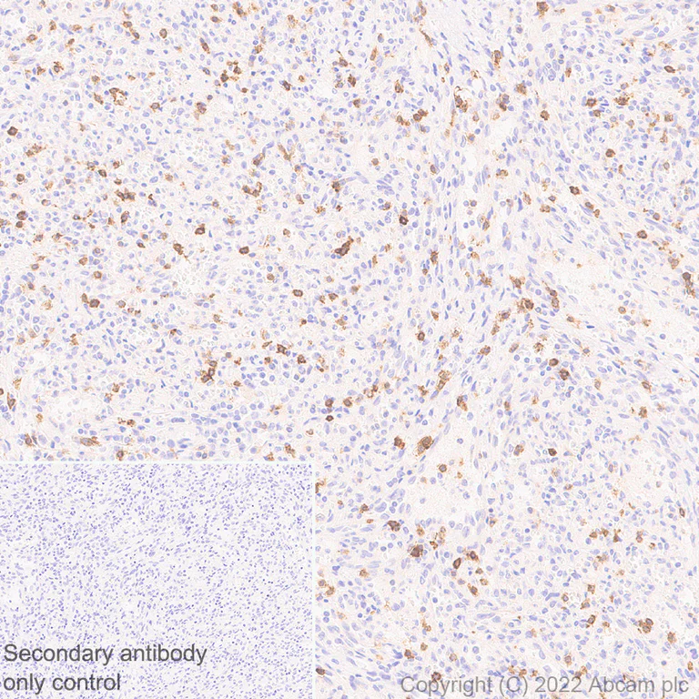 Immunohistochemistry (Formalin/PFA-fixed paraffin-embedded sections) - Anti-CD161 antibody [EPR26340-6] (BSA and Azide free) (AB302565)