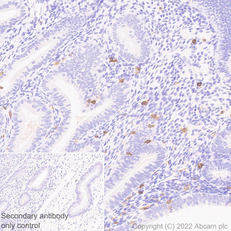 Immunohistochemistry (Formalin/PFA-fixed paraffin-embedded sections) - Anti-CD161 antibody [EPR26340-6] (BSA and Azide free) (AB302565)