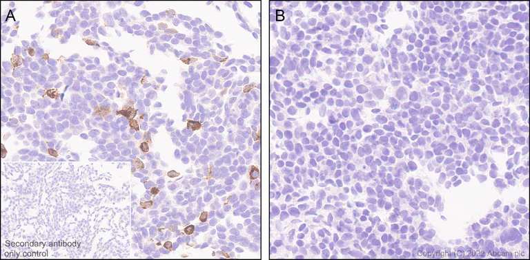 Immunohistochemistry (Formalin/PFA-fixed paraffin-embedded sections) - Anti-CD161 antibody [EPR26340-6] (BSA and Azide free) (AB302565)