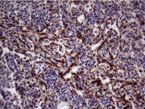 Immunohistochemistry (Formalin/PFA-fixed paraffin-embedded sections) - Anti-CD161 antibody [OTI1D8] - BSA and Azide free (AB273666)