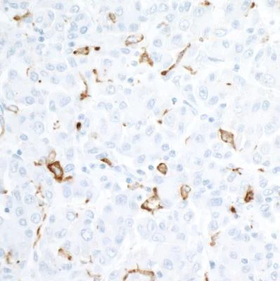 Immunohistochemistry (Formalin/PFA-fixed paraffin-embedded sections) - Anti-CD163 antibody [BLR087G] (AB265592)