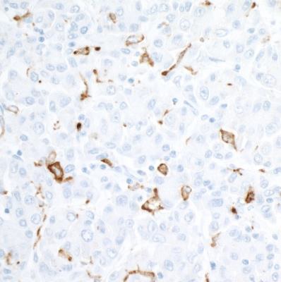 Immunohistochemistry (Formalin/PFA-fixed paraffin-embedded sections) - Anti-CD163 antibody [BLR087G] - BSA free (AB272066), expandable thumbnail