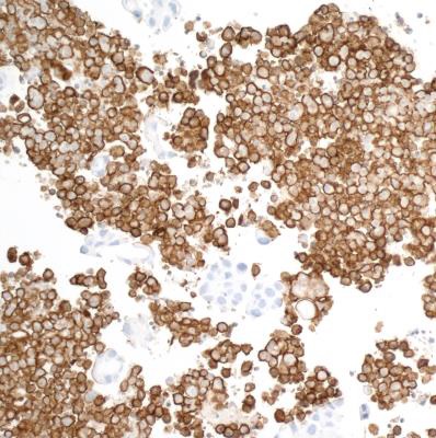 Immunohistochemistry (Formalin/PFA-fixed paraffin-embedded sections) - Anti-CD163 antibody [BLR087G] - BSA free (AB272066), expandable thumbnail