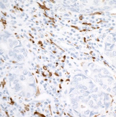 Immunohistochemistry (Formalin/PFA-fixed paraffin-embedded sections) - Anti-CD163 antibody [BLR087G] - BSA free (AB272066), expandable thumbnail