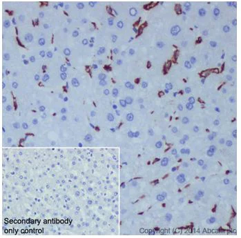 Immunohistochemistry (Formalin/PFA-fixed paraffin-embedded sections) - Anti-CD163 antibody [EPR14336] (AB199427)