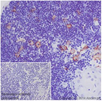 Immunohistochemistry (Formalin/PFA-fixed paraffin-embedded sections) - Anti-CD163 antibody [EPR14336] (AB199427)