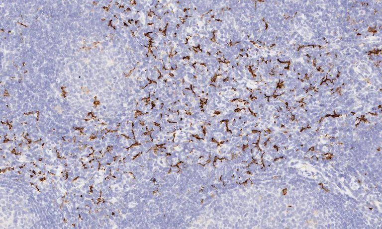 Immunohistochemistry (Formalin/PFA-fixed paraffin-embedded sections) - Anti-CD163 antibody [EPR14643-36] - C-terminal (AB189915)