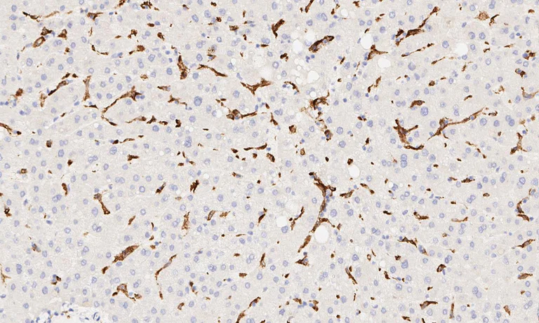 Immunohistochemistry (Formalin/PFA-fixed paraffin-embedded sections) - Anti-CD163 antibody [EPR14643-36] - C-terminal (AB189915)