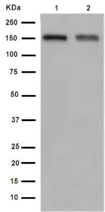 Western blot - Anti-CD163 antibody [EPR14643-36] - C-terminal (AB189915)