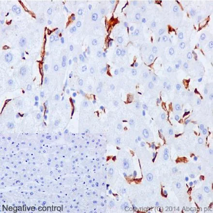 Immunohistochemistry (Formalin/PFA-fixed paraffin-embedded sections) - Anti-CD163 antibody [EPR14643-36] - Low endotoxin, Azide free (AB215976)