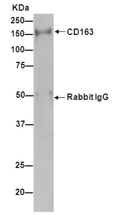 Immunoprecipitation - Anti-CD163 antibody [EPR14643-36] - Low endotoxin, Azide free (AB215976)