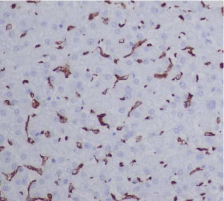 Immunohistochemistry (Formalin/PFA-fixed paraffin-embedded sections) - Anti-CD163 antibody [EPR14643] - C-terminal (AB188571), expandable thumbnail