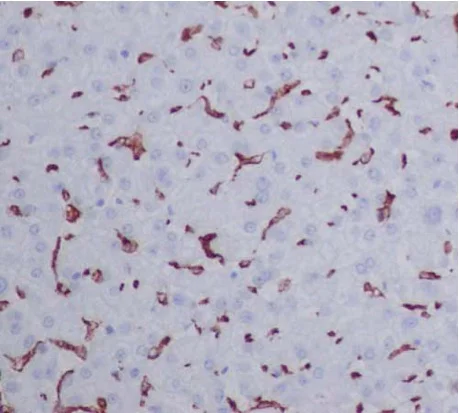 Immunohistochemistry (Formalin/PFA-fixed paraffin-embedded sections) - Anti-CD163 antibody [EPR14643] - C-terminal (AB188571)