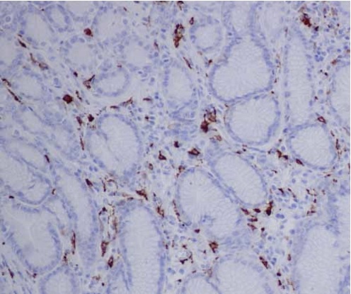 Immunohistochemistry (Formalin/PFA-fixed paraffin-embedded sections) - Anti-CD163 antibody [EPR14643] - C-terminal (AB188571), expandable thumbnail