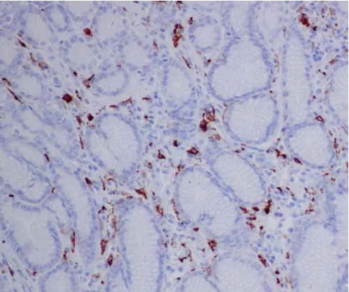 Immunohistochemistry (Formalin/PFA-fixed paraffin-embedded sections) - Anti-CD163 antibody [EPR14643] - C-terminal (AB188571)