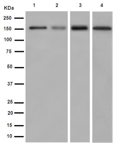 Western blot - Anti-CD163 antibody [EPR14643] - C-terminal (AB188571), expandable thumbnail