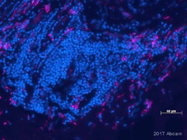 Immunohistochemistry (Formalin/PFA-fixed paraffin-embedded sections) - Anti-CD163 antibody [EPR19518] (AB182422)