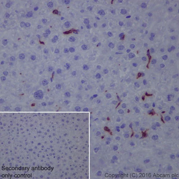 Immunohistochemistry (Formalin/PFA-fixed paraffin-embedded sections) - Anti-CD163 antibody [EPR19518] (AB182422)