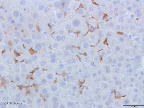 Immunohistochemistry (Formalin/PFA-fixed paraffin-embedded sections) - Anti-CD163 antibody [EPR19518] (AB182422)