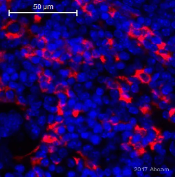 Immunohistochemistry (Formalin/PFA-fixed paraffin-embedded sections) - Anti-CD163 antibody [EPR19518] (AB182422)