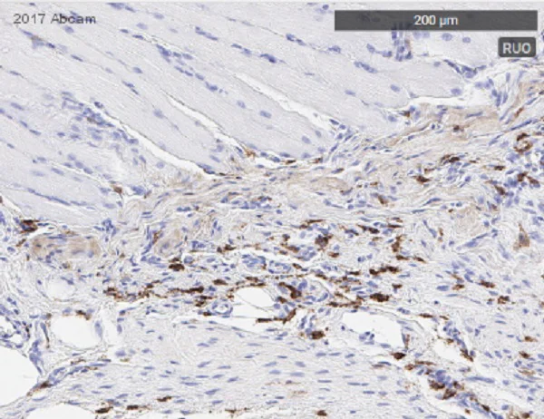 Immunohistochemistry (Formalin/PFA-fixed paraffin-embedded sections) - Anti-CD163 antibody [EPR19518] (AB182422)