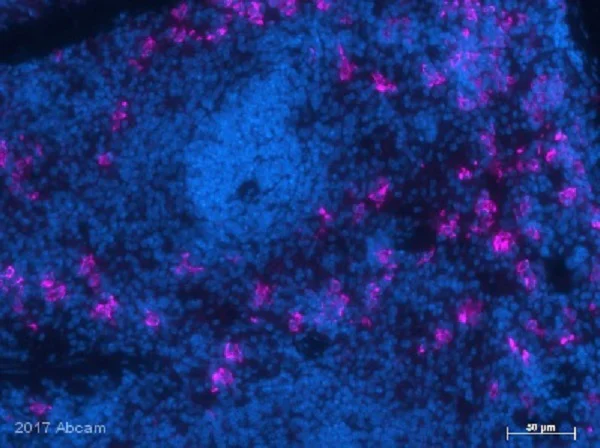 Immunohistochemistry (Formalin/PFA-fixed paraffin-embedded sections) - Anti-CD163 antibody [EPR19518] (AB182422)
