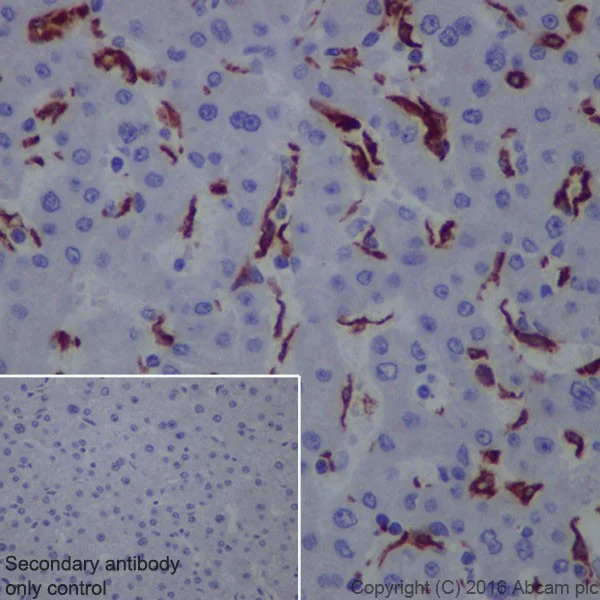 Immunohistochemistry (Formalin/PFA-fixed paraffin-embedded sections) - Anti-CD163 antibody [EPR19518] (AB182422)