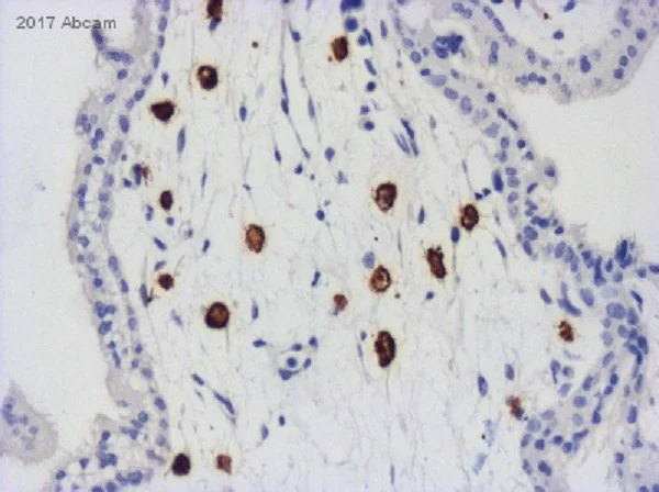 Immunohistochemistry (Formalin/PFA-fixed paraffin-embedded sections) - Anti-CD163 antibody [EPR19518] (AB182422)