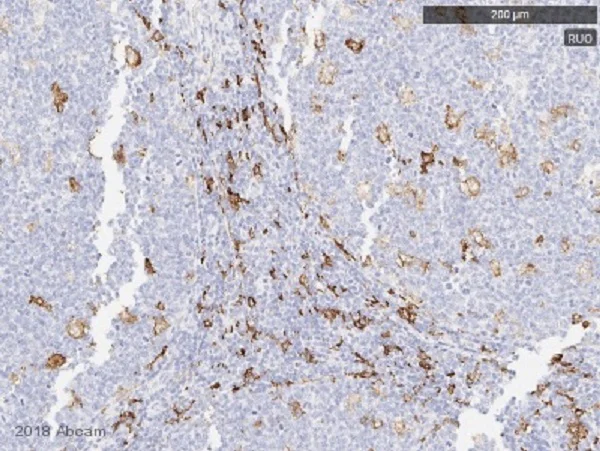 Immunohistochemistry (Formalin/PFA-fixed paraffin-embedded sections) - Anti-CD163 antibody [EPR19518] (AB182422)