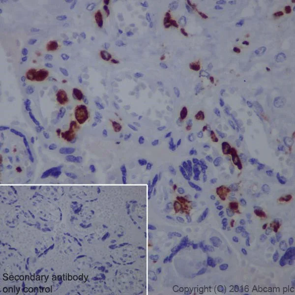 Immunohistochemistry (Formalin/PFA-fixed paraffin-embedded sections) - Anti-CD163 antibody [EPR19518] (AB182422)