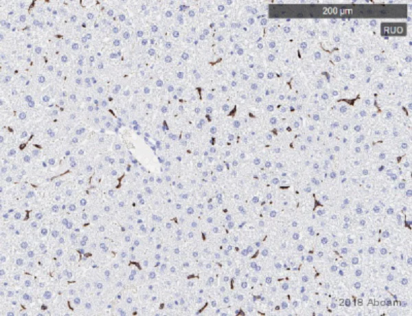 Immunohistochemistry (Formalin/PFA-fixed paraffin-embedded sections) - Anti-CD163 antibody [EPR19518] (AB182422)