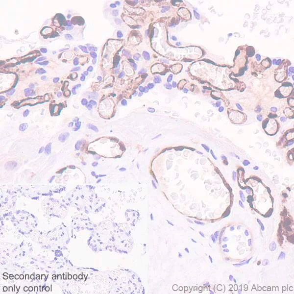 Immunohistochemistry (Formalin/PFA-fixed paraffin-embedded sections) - Anti-CD163 antibody [EPR19518] (AB182422)